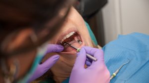 Dental Insurance Coverage for Gum Disease