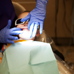 Use Your Coverage to Take Advantage of Sealants