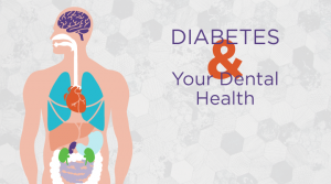 Because individuals diagnosed with diabetes have high blood sugar levels, they often have problems with their teeth and gums, making dental care for diabetics a critical part of care.