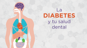 Debido a que las personas diagnosticadas con diabetes tienen niveles altos de azúcar en la sangre, a menudo tienen problemas con los dientes y las encías, lo que hace que el cuidado dental para los diabéticos sea una parte crítica de la atención.