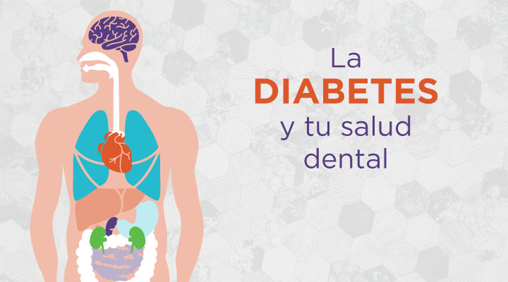 Debido a que las personas diagnosticadas con diabetes tienen niveles altos de azúcar en la sangre, a menudo tienen problemas con los dientes y las encías, lo que hace que el cuidado dental para los diabéticos sea una parte crítica de la atención.