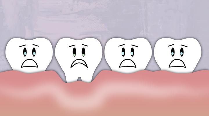 A receding gum line can’t grow back, but it can be prevented. Learn more about what causes our gums to recede.