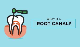 Root canals are a dental procedure that treats infection in teeth. Without root canals, serious infections can occur. Find out what to expect during the procedure.