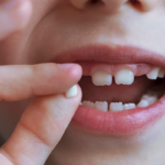 Child holing up their baby tooth.