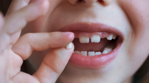 Child holing up their baby tooth.