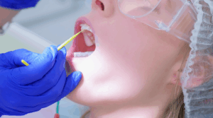 Person at the dentist, getting fluoride applied to their teeth.